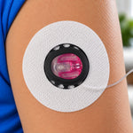 Black Freedom Cannula Guard protecting a Tandem compatible infusion site