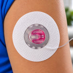Blue Freedom Cannula Guard for Tandem insulin pump infusion set