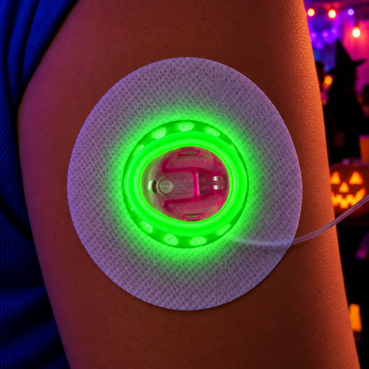Green Freedom Cannula Guard for Tandem infusion set protection