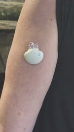 Protective Overlay Guard For Medtronic Guardian 3 & 4 | Soft & Flexible Armor Overlay Case