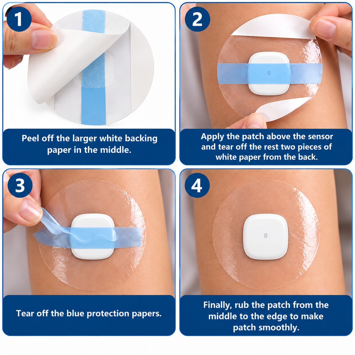 Clear overpatch application steps for the Medtronic Simplera Sync sensor