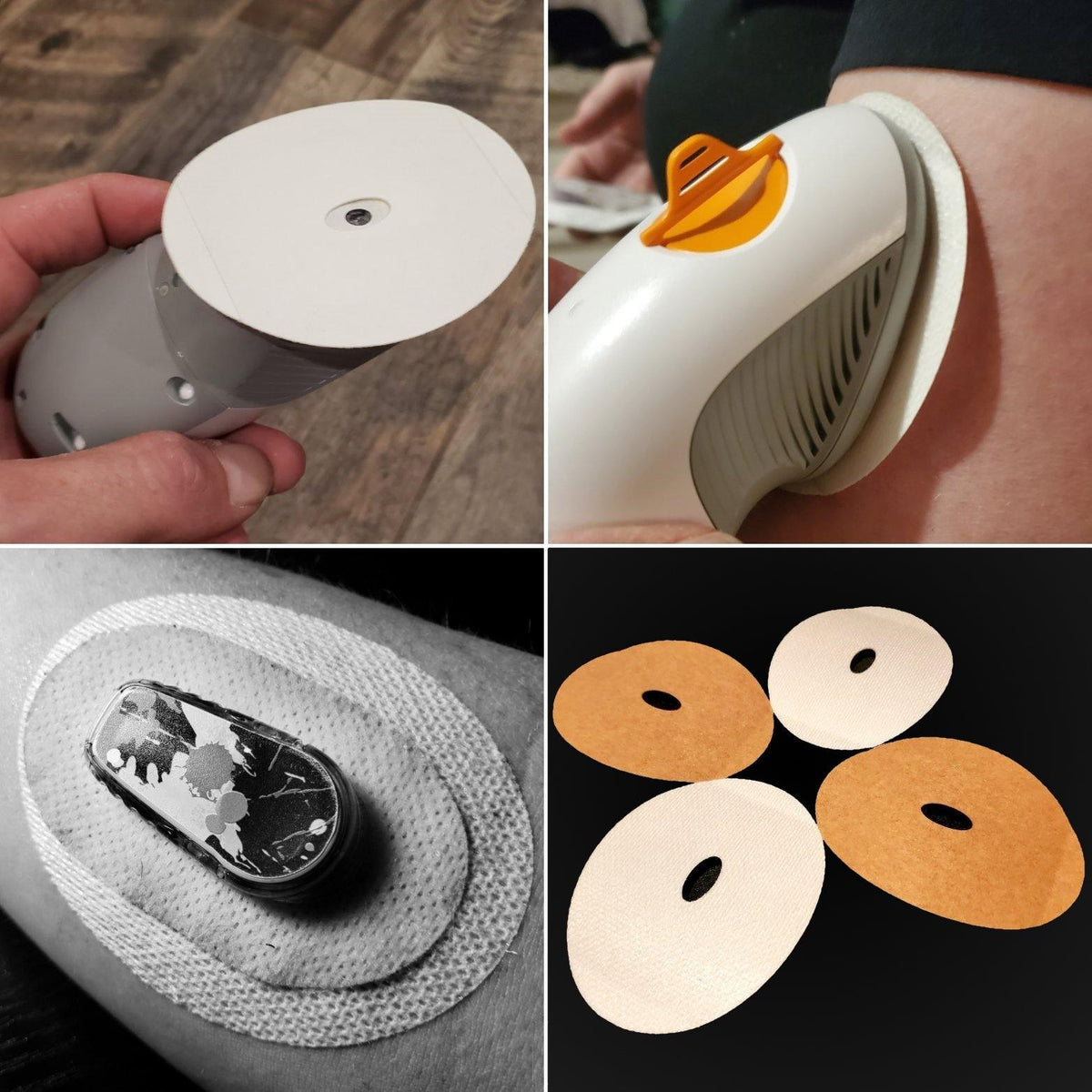 Dexcom G6 : Allergy Underlay Skin Barrier Adhesive Patches : Armband ...